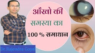 Homeopathic medicine Cineraria Maritima For eye problems vision defectsमोतियाबिंद जड़ से ख़त्म [upl. by Finah878]