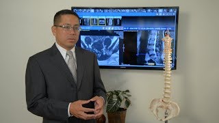 What is a Herniated Disc Symptoms amp Treatment Options Explained by Dr Rey Bosita [upl. by Halihs566]