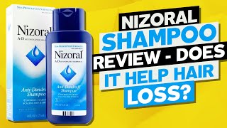 Nizoral Shampoo Review  Does it Help Hair Loss [upl. by Seleta]