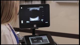 How To ScanAlong Visual Guides on the Sonosite XPorte 3D Video [upl. by Brocky]