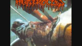 Agathocles  A for arrogance [upl. by Eadwine]