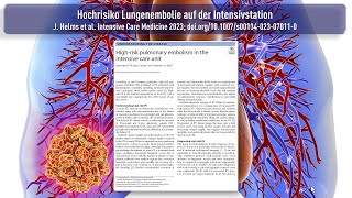 Hochrisiko Lungenembolie auf der Intensivstation [upl. by Aeli]