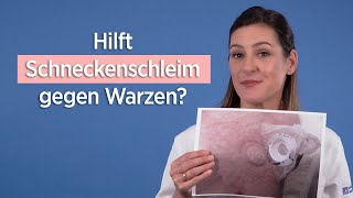 Hilft Schneckenschleim gegen Warzen [upl. by Nonohcle129]