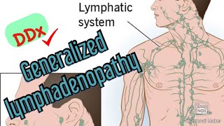 Approach to Diagnosing Generalized Lymphadenopathy [upl. by Eynahpets819]