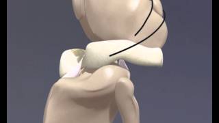 Cranial Cruciate Ligament Rupture  3D Animation for Veterinary Undergraduates [upl. by Sidra]