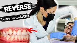 How To Treat Gum Disease [upl. by Ellehcer]