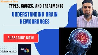 Understanding Brain Hemorrhage Types Causes Treatment DrRakshitaSingh fedevigevani felipeneto [upl. by Ellenyl]