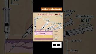 blood collection technique how to draw blood from veins needle syringe inserting techniques [upl. by Aleta485]