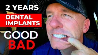 The GOOD and BAD Of My Dental Implants After 2 Years [upl. by Columba]