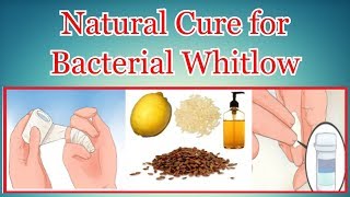 Natural Cure for Bacterial Whitlow [upl. by Maffa727]