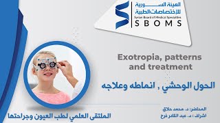 Exotropia patterns and treatment  الحول الوحشي انماطه وعلاجه [upl. by Nwahsit]