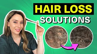 Hair Loss Treatments That Actually Work for Women amp Men  Dr Shereene Idriss [upl. by Arretahs]