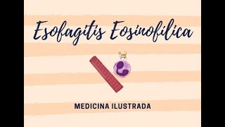 Esofagitis Eosinofílica [upl. by Oiciruam551]