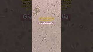 Giardia lamblia under the microscope laboratory microscope mls cls medtechstudent [upl. by Nnailuj]