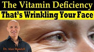 The Vitamin Deficiency Thats Wrinkling Your Face Linked to Low Bone Mass  Dr Alan Mandell DC [upl. by Abernathy]