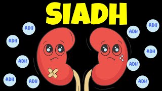 What is SIADH AntiDiuretic Hormone Syndrome [upl. by Wachter]