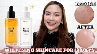 14 Days Challenge  NACIFIC Phyto Niacin Whitening Essence amp Fresh Herb Origin Serum Glass Skin [upl. by Neelcaj]