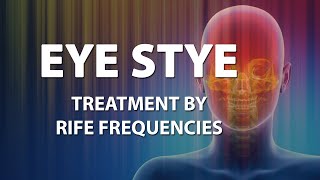 Eye Stye  RIFE Frequencies Treatment  Energy amp Quantum Medicine with Bioresonance [upl. by Yelnoc]