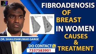 Fibrocystic Breast Causes Signs and Symptoms Diagnosis and Treatment [upl. by Zamir55]