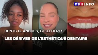 Dents blanches gouttières  les dérives de lesthétique dentaire [upl. by Wye]