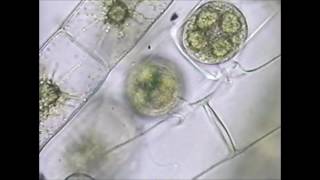 Spirogyra Conjugation [upl. by Nairdna]