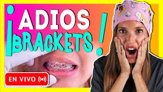 🎥𝐑𝐄𝐓𝐈𝐑𝐎 𝐝𝐞 𝐎𝐑𝐓𝐎𝐃𝐎𝐍𝐂𝐈𝐀 en 𝒗𝒊𝒗𝒐 Como se 𝗤𝗨𝗜𝗧𝗔𝗡 los BRACKETS y se ponen los RETENEDORES ORTODONCIA🔥 [upl. by Luapleahcim]