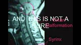 Chiari awareness video [upl. by Griffy176]