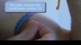 Programa de Aumento de masa muscular en biceps triceps con electroestimulacion [upl. by Eustacia]