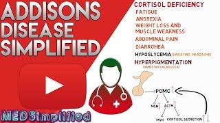 Addisons Disease Made Simple  Primary Adrenal Faliure [upl. by Salisbury]