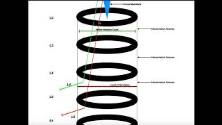 Relation Between Disc Herniation amp Compressed Nerve Root Levels [upl. by Florin]