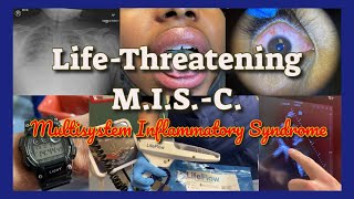 Life Threatening Multisystem Inflammatory Syndrome in Children MIS C Emergency [upl. by Schofield602]