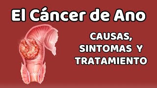 EL CÁNCER DE ANO Causas signos y síntomas diagnóstico y tratamiento [upl. by Herriott]