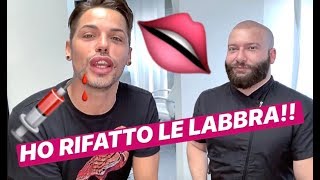 HO RIFATTO LE LABBRA LA MIA ESPERIENZA video esplicito [upl. by Burton95]