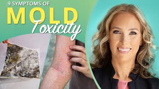 Mold Toxicity  9 Symptoms of Mold Toxicity  Dr J9 Live [upl. by Callean898]