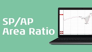 Using the SPAP Area Ratio for Diagnosis of Menieres Disease [upl. by Curcio]