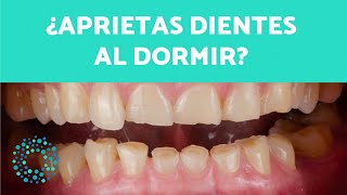 ¿Aprietas DIENTES al DORMIR Causas y SOLUCIONES para el BRUXISMO [upl. by Ruomyes746]