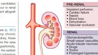 Medicine 0433 Acute Kidney Injury Renal Failure Chronic [upl. by Okihcim393]