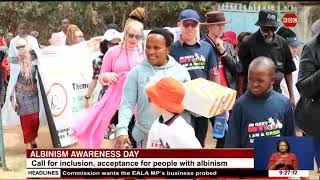 Albinism Awareness Day I Call for inclusion and acceptance for people with albinism [upl. by Dor]