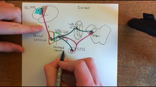 Parkinsons Disease and Antiparkinson Drugs Part 9 [upl. by Ainnet]