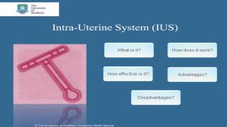 IntraUterine System IUS [upl. by Solhcin]