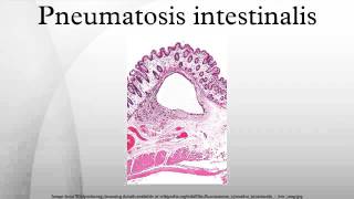 Pneumatosis intestinalis [upl. by Cilka]