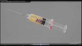 ACP Autologous Conditioned Plasma  Arthrex [upl. by Pooley]