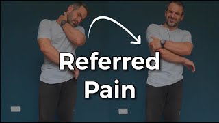 Referred Neck Pain [upl. by Ettevol335]