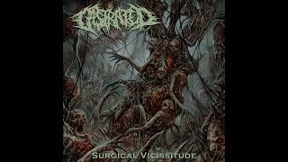 Castrated  Surgical Vicissitude Full EP [upl. by Hpeseoj759]