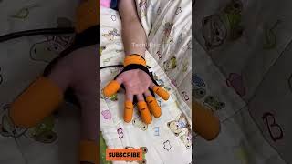 Mechanical Therapy Rehabilitation Gloves dealsproducts gadgets [upl. by Anuahsal]