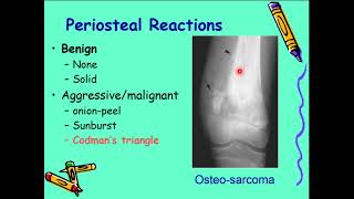 Bone tumors who to characterize a lesion [upl. by Noteloc]