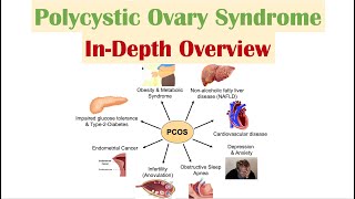 Polycystic Ovary Syndrome PCOS  Overview of Associated Conditions Diagnosis amp Treatments [upl. by Eittam]