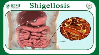 Shigellosis What Causes Shigellosis Shigella Morphology Classification Transmission amp Treatment [upl. by Ecirtemed]