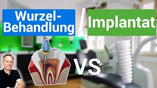 Implantat oder Wurzelbehandlung Was ist besser Zahnerhalt oder Zahn ziehen [upl. by Ragse]