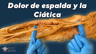 El PEOR tipo de dolor de ESPALDA hernias discales y ciática [upl. by Nutter]